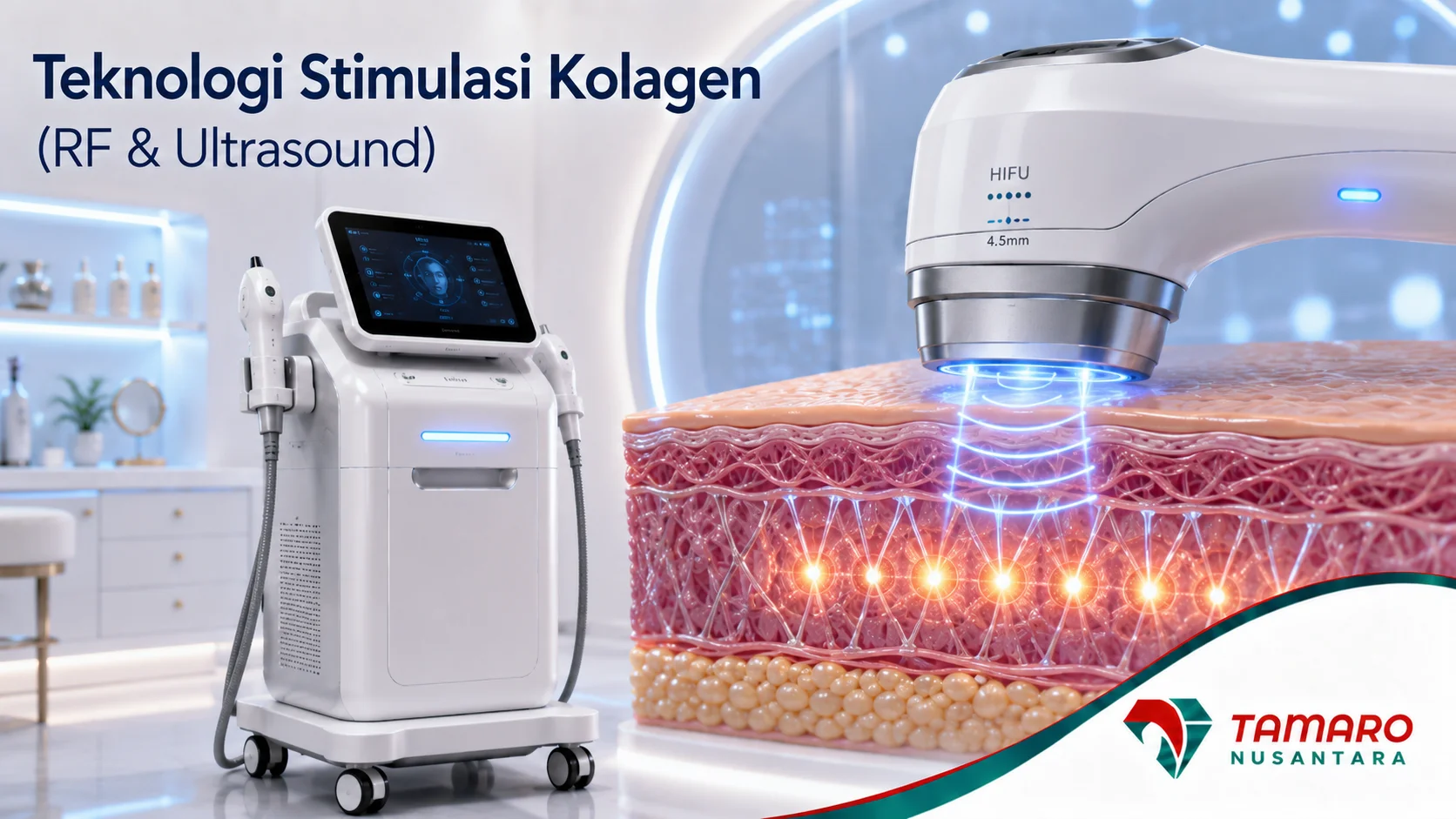 Ilustrasi cara kerja alat ultrasound standar medis untuk pengencangan kulit non-invasif.